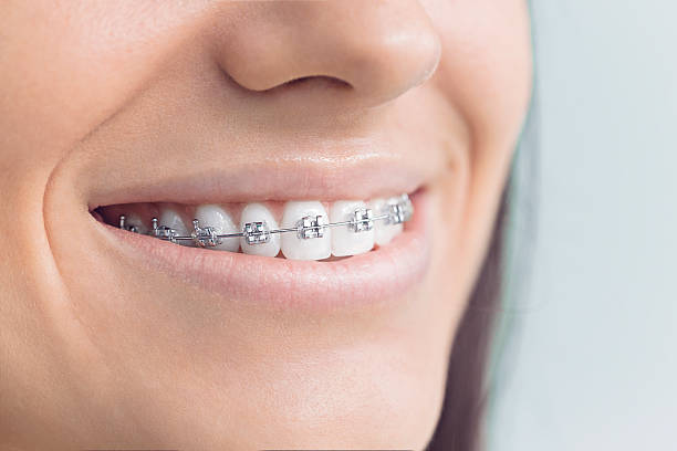 Best Invisalign and Clear Aligners  in Aviston, IL